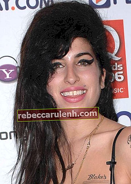 Amy Winehouse hatte einen Zahnlücken