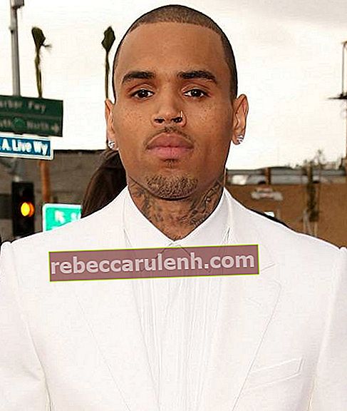 Chris Brown Gesicht